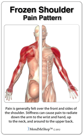 shoulder pain can be caused by a deep ligament and frozen shoulder injury