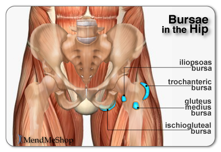 Tendinitis in the Hip