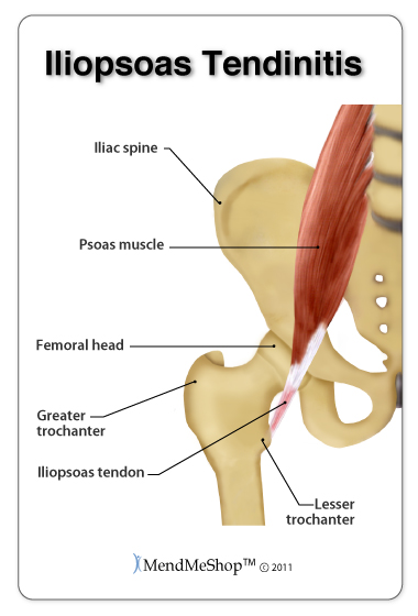 Hip-Fin Hip Flexor Release Tool - Psoas and Iliacus Muscle, Hip, Back, Leg  Pain Relief - Size Large