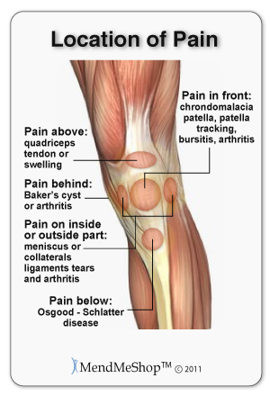 knee pain location map