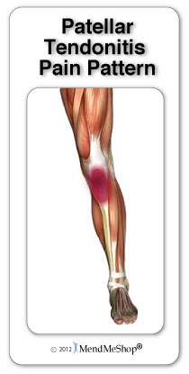 Patellar tendon pain radiates under the knee cap