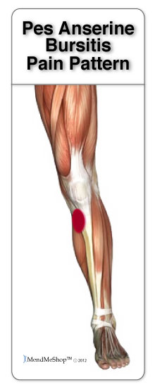 pes anserine bursa pain patterns