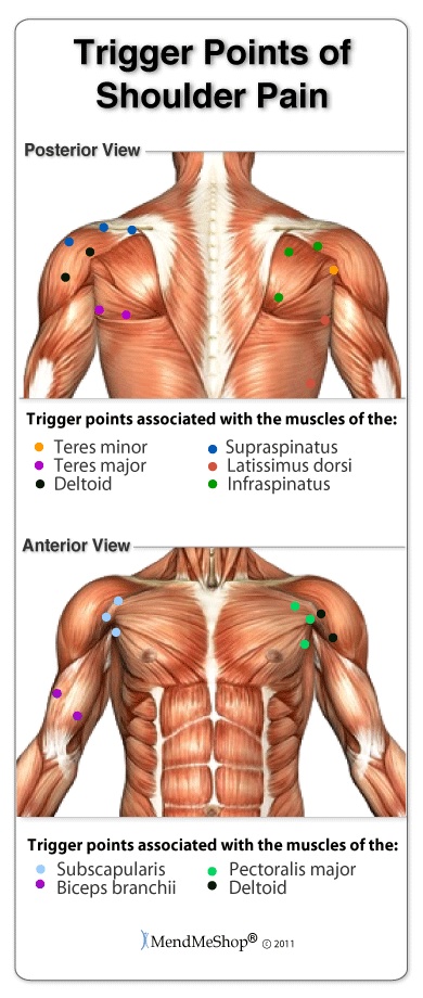 Shoulder Trigger Points